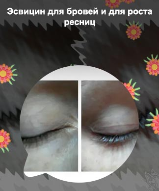 Эсвицин для роста ресниц и бровей отзывы