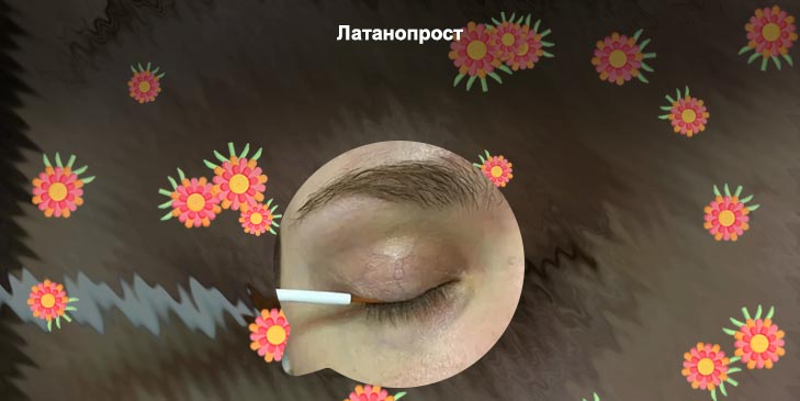 Латанопрост для роста ресниц